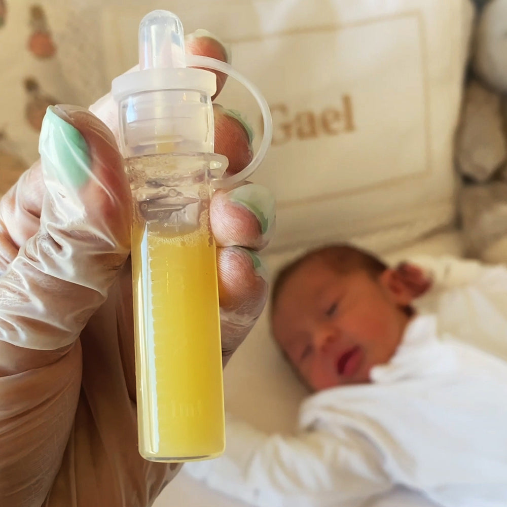 Collecting Colostrum in Pregnancy: What It Is, Why People Do It, and How to Do It